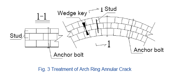 Treatment-of-Arch-Ring-Annular-Crack